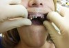 Фото Протезирование и лечение зубов
