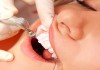 Фото Стоматология 24 .Акция на лечение зубов