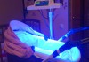 Фото Лапа для лечения желтушки новорожденных