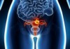 Лечение рака эндометрия (рака тела матки) в Харбине
