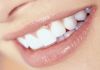 Отбеливающие средства для зубов в домашних условиях